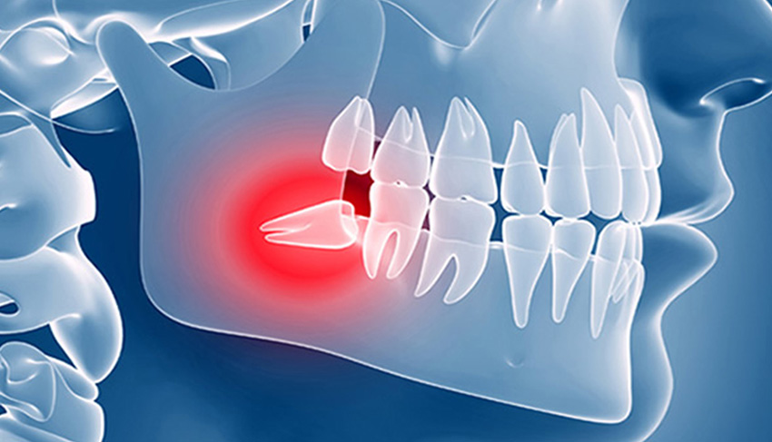 cirugia oral en guadalajara