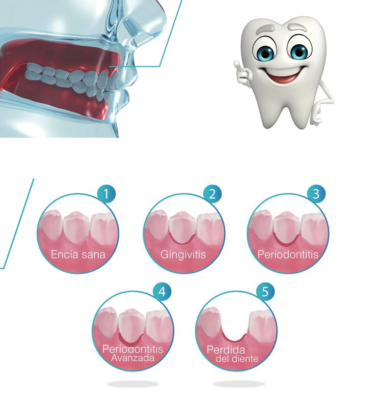 periodoncia guadalajara