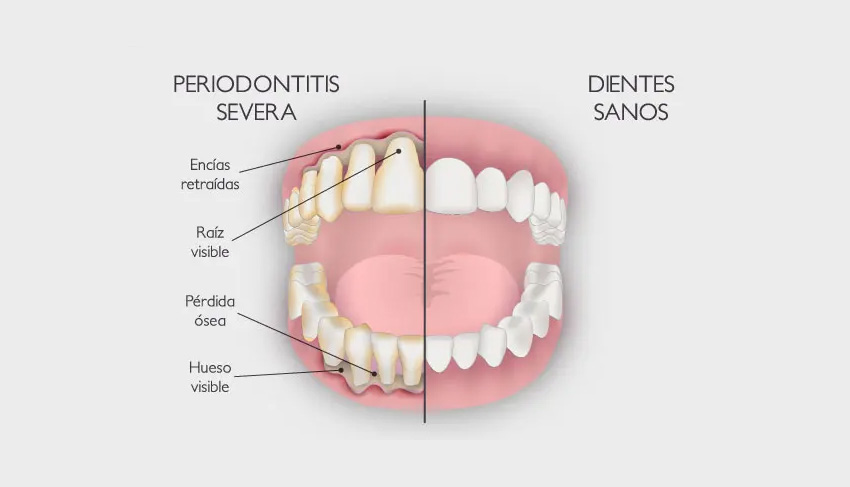 periodoncia guadalajara